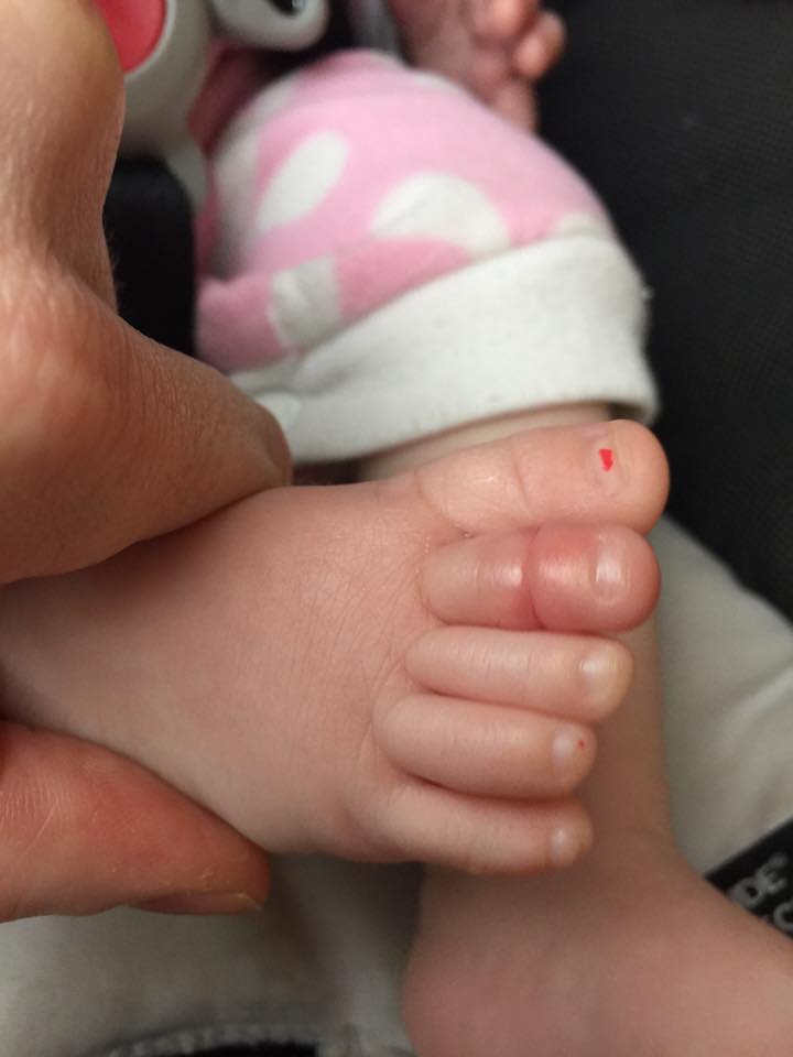 赤ちゃんの靴下の中で起きてしまう止血に注意 Dallajapa Com